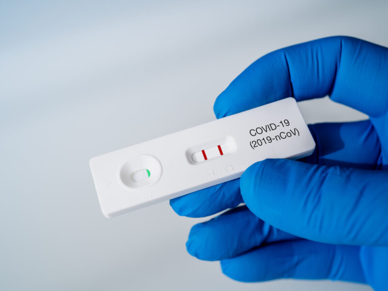 Doctor holding a Positive Result for COVID-19 with test kit for