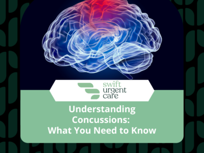 Understanding Concussions: What You Need to Know